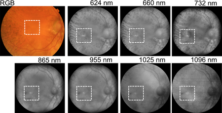 Advanced Imaging